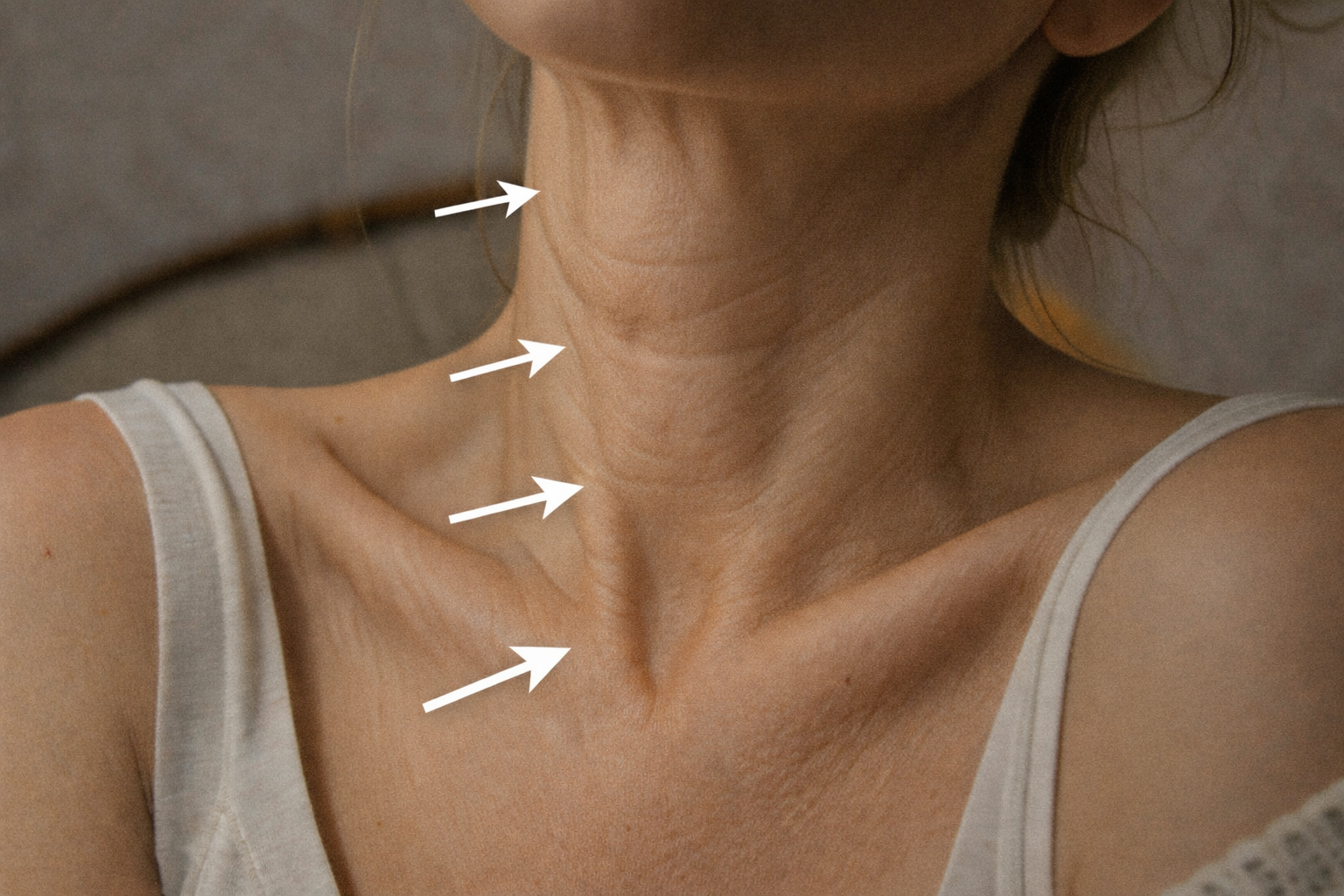 tratamiento cuello y escote